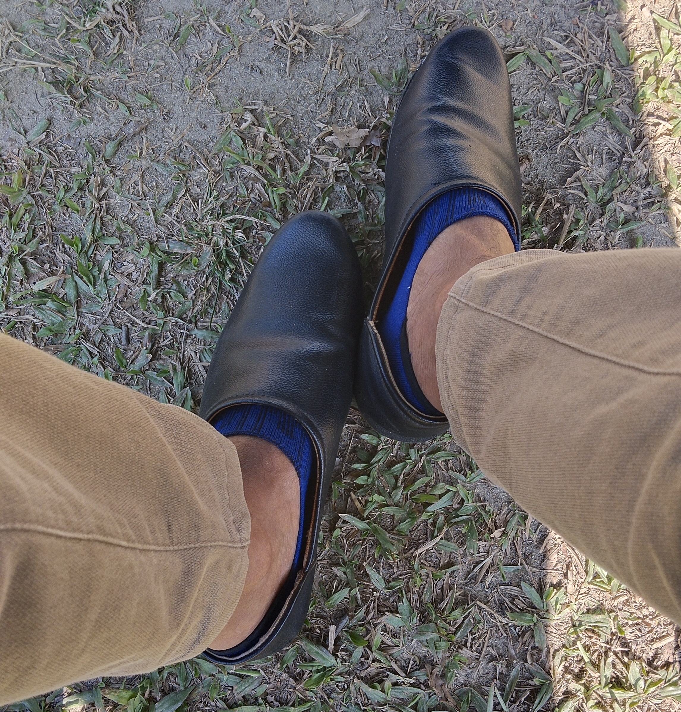 Shoes on feet, showing why pressure and fit matter for recurring callus