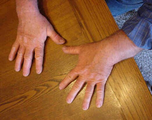 A close image of hands and foot care used to represent gentle checking before treatment
