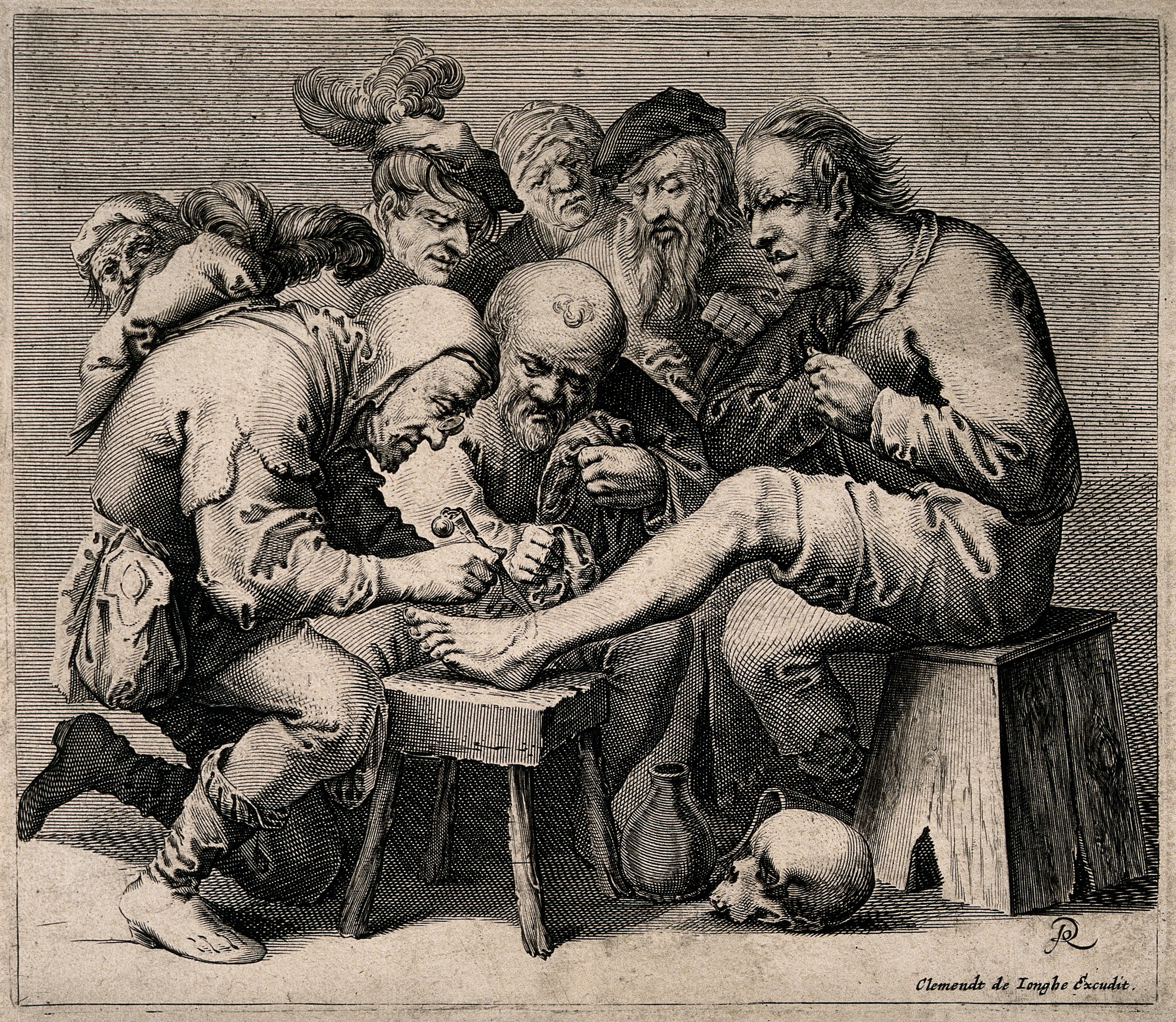 Historical image of a chiropodist treating a patient while others wait