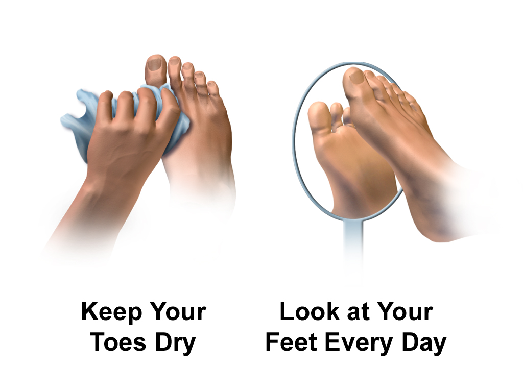 Illustration showing feet being dried and checked with a mirror