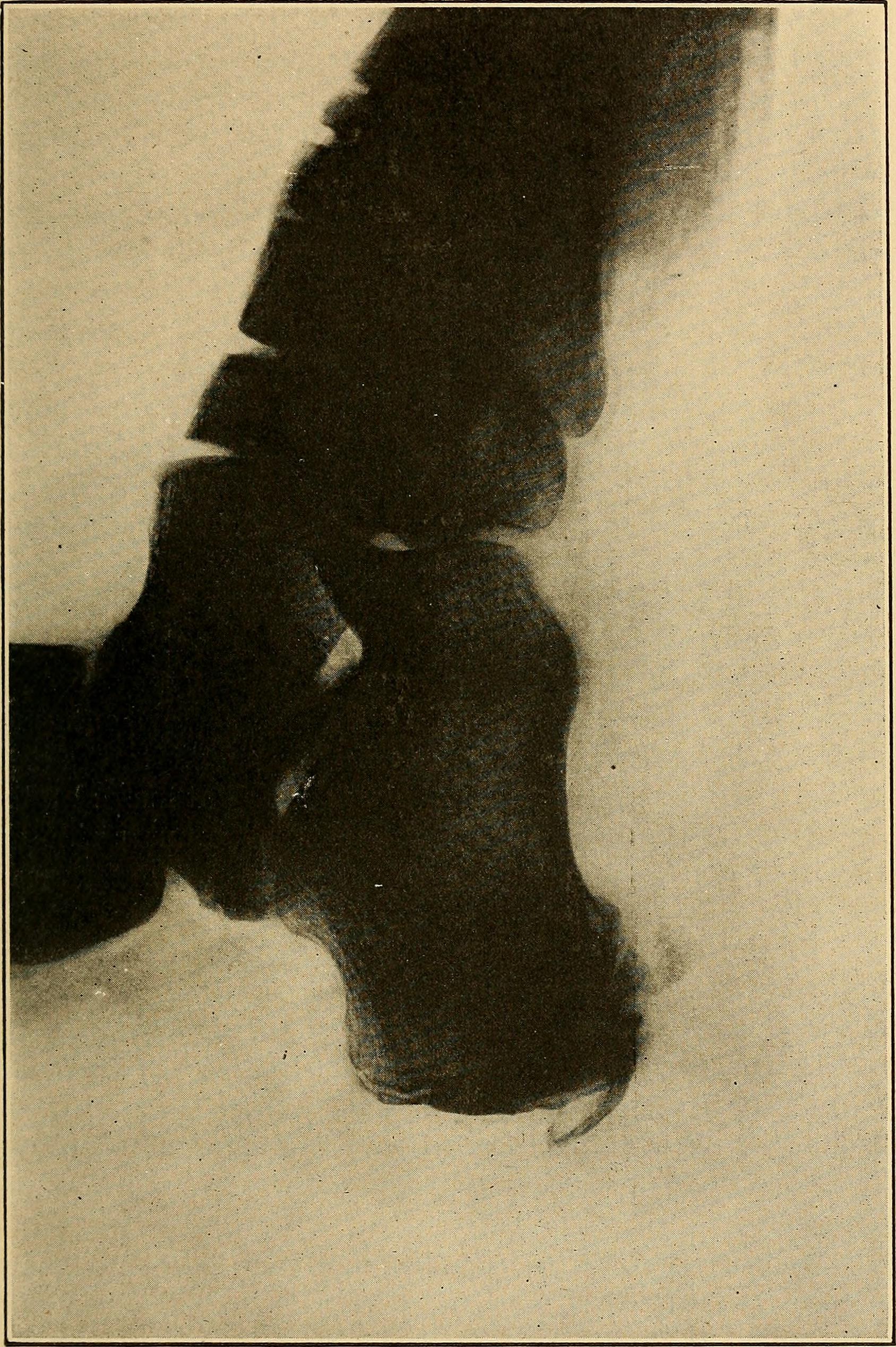 A podiatry textbook page used to represent foot care notes before an appointment