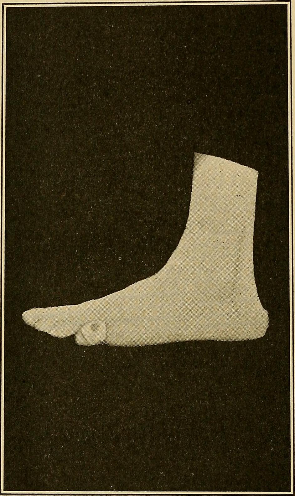 A podiatry illustration used to represent checking feet before a home visit