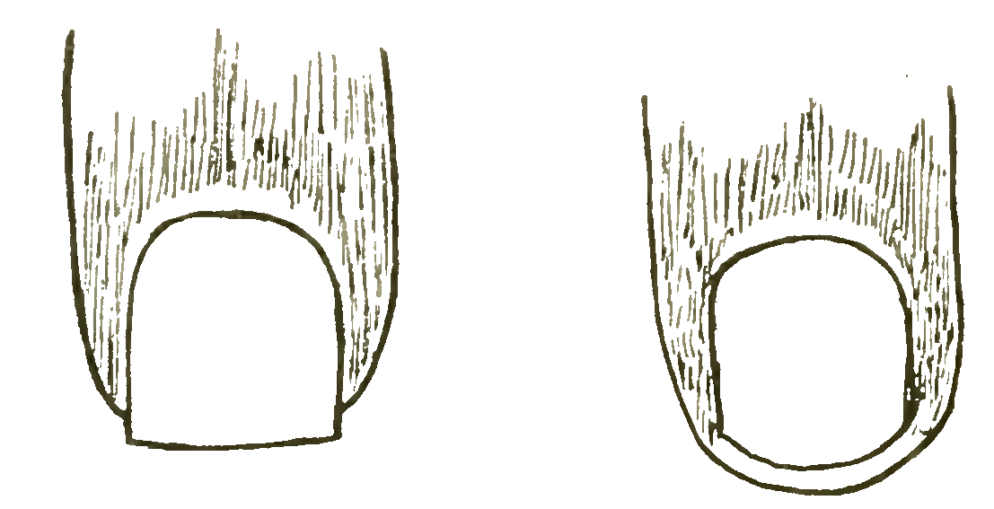 Diagram showing safer straight toenail trimming compared with rounded corner cutting