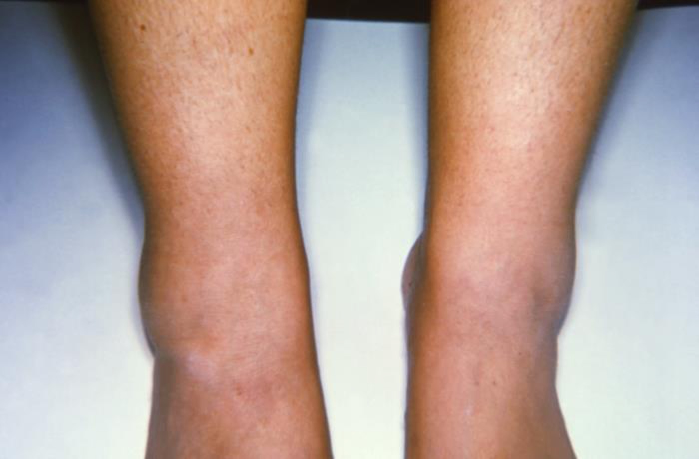 An older adult's feet and ankles being checked during a foot care visit