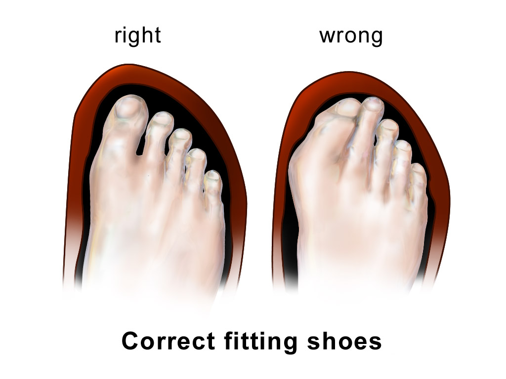 Illustration of checking how footwear fits as part of foot care